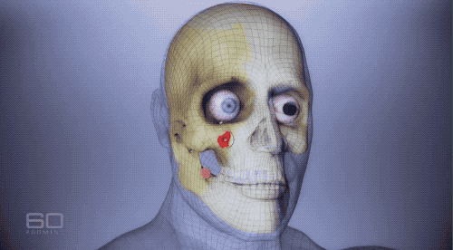 ookp 的第二步(图片来源:见水印)然后要把脸颊再次剌开,把牙齿和里面