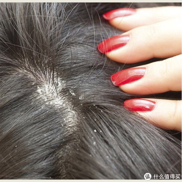 头皮屑多要什么洗发水好??|去屑_新浪新闻