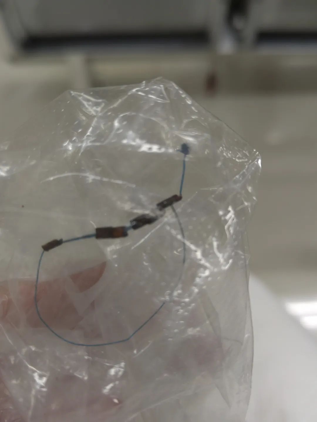 静湖体内取出的节育环