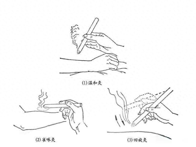 汤医科普 | 且行且珍"膝",艾灸来助力