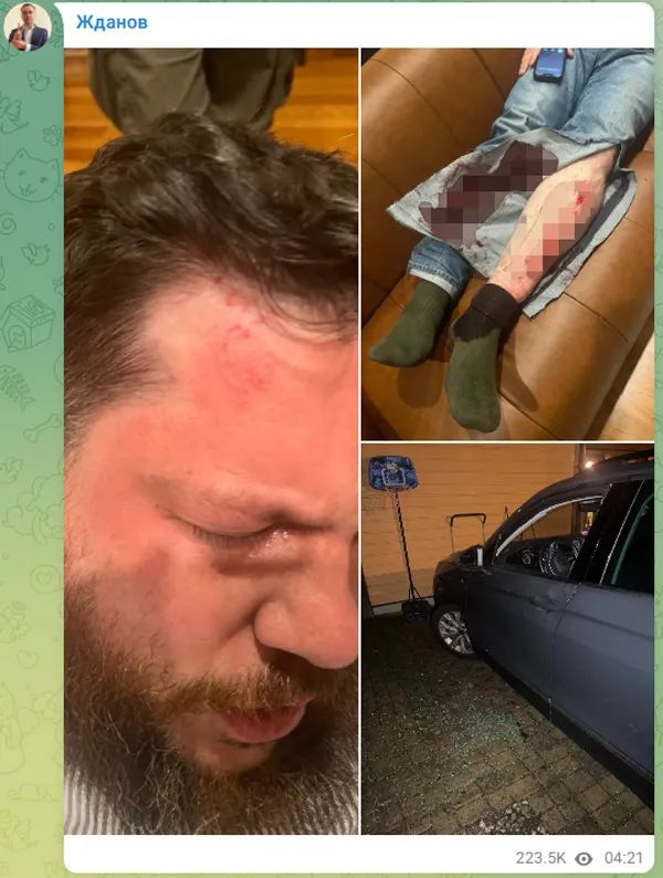 纳瓦利内前幕僚长遇袭,立陶宛指控俄罗斯_新浪财经_新浪网