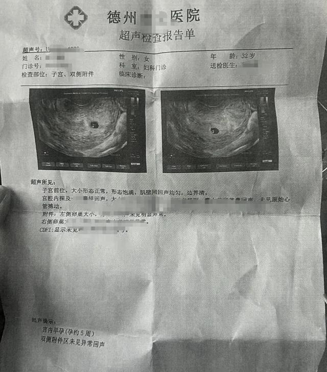 怀孕的超声检查报告单图片