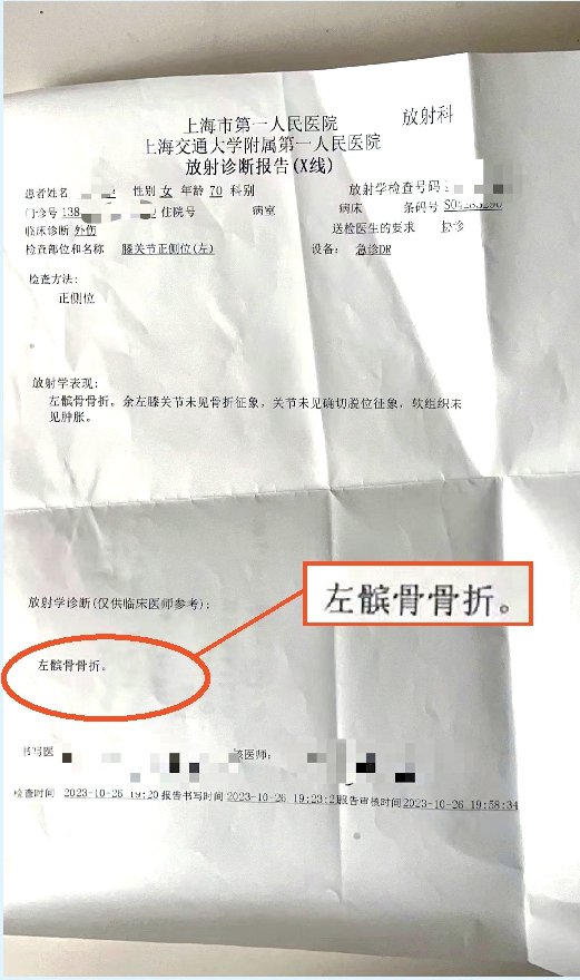 医院x光片诊断为左髌骨骨折