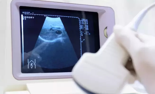 如果血hcg值低,妇科b超未能发现妊娠囊,需隔日复查血hcg.