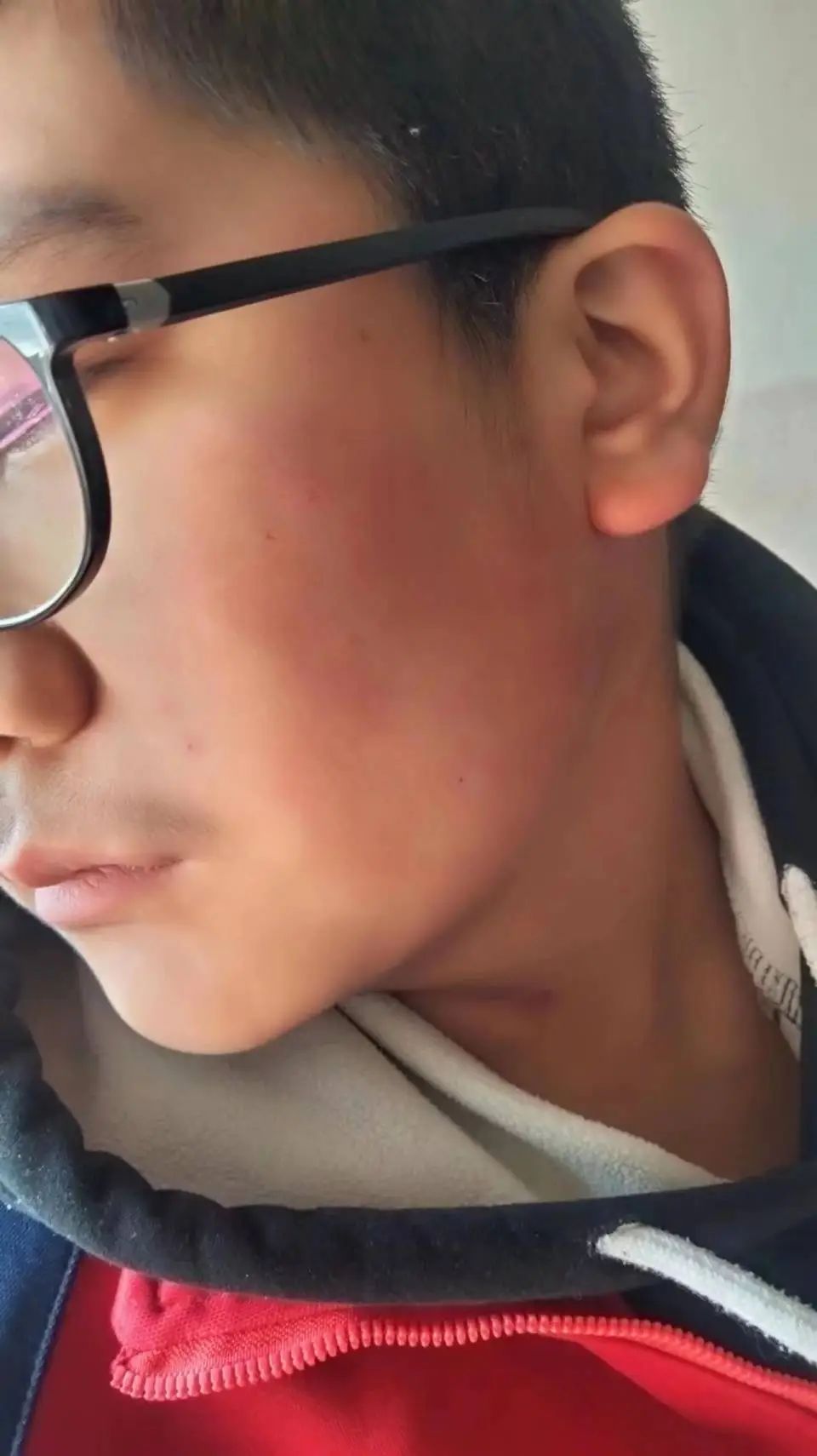 胡女士弟弟被老师打了三个耳光(受访者供图)