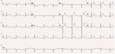 年轻小伙反复心肌炎!这个病史竟成了诊断关键.|马修_新浪财经_新浪网