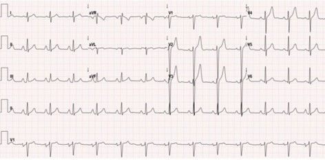 年轻小伙反复心肌炎!这个病史竟成了诊断关键.|马修_新浪财经_新浪网