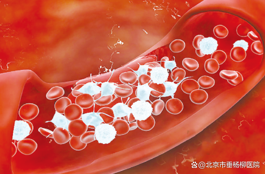垂医科普 | 血小板减少的原因有哪些?