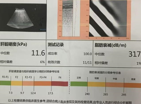 32岁小伙大腹便便没当回事,一检查竟然……|脂肪肝_新浪财经_新浪网