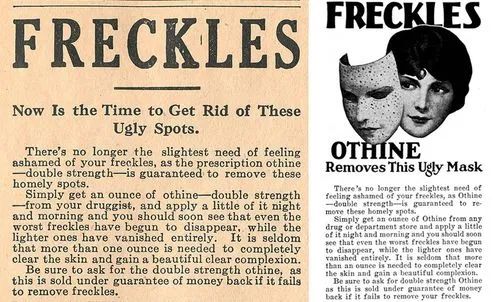 ▲1914-1928年Othine祛斑霜广告。