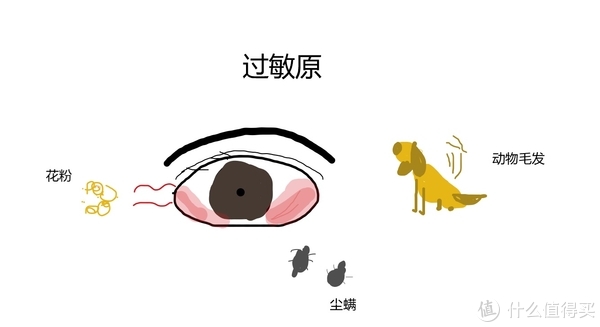 跟着我一起来看看过敏性结膜炎的表现和治疗，特别是家有小朋友的值友，让我们一起打败它|过敏性皮炎|过敏性鼻炎|过敏性哮喘|眼科|滴眼液_新浪新闻