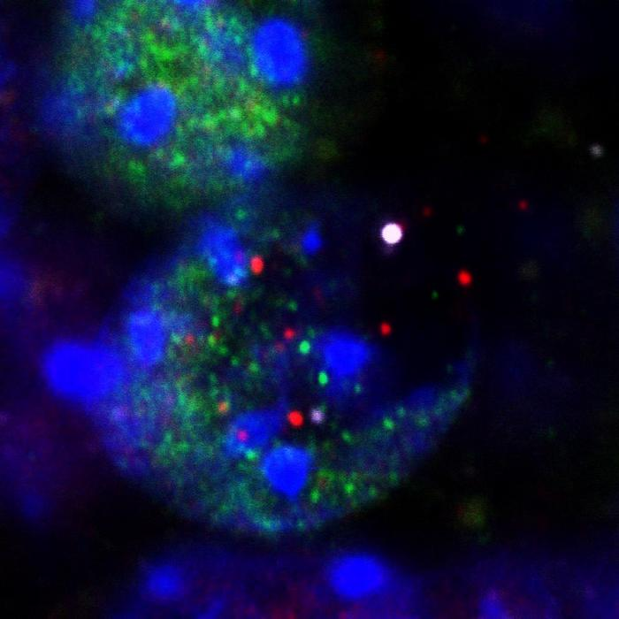此图显示了学习过程中神经元细胞核DNA受到损伤，释放出DNA（右中大白点）、组蛋白（紫色）和转录因子（红色和绿色）。