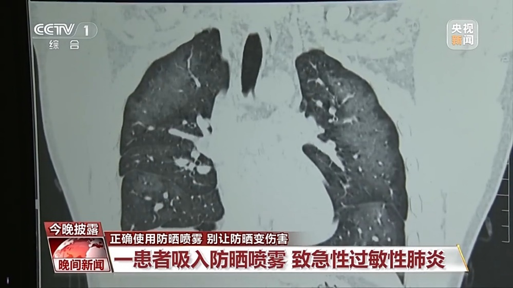 图源：央视<a href=