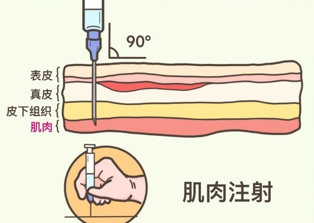 汤医科普 | 肌肉注射常识,你了解多少