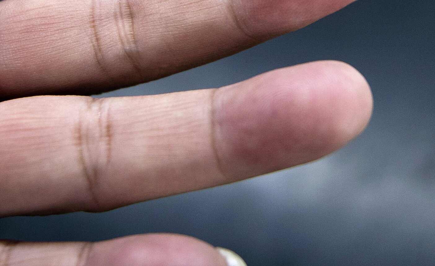 李裕杰左手无名指指纹因多年打磨已被磨平。（张睿 摄）