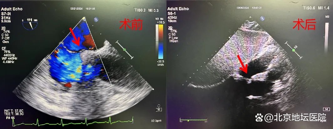 术前和术后影像照片