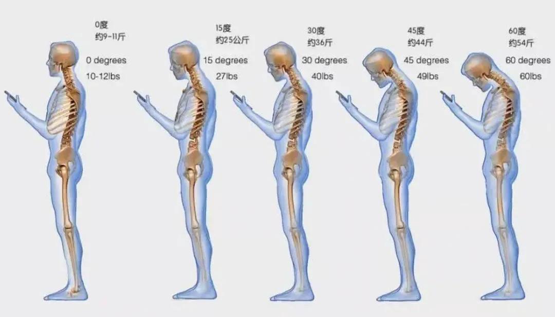 低头角度与脊椎承受压力的示意图，图片来源：boostphysio