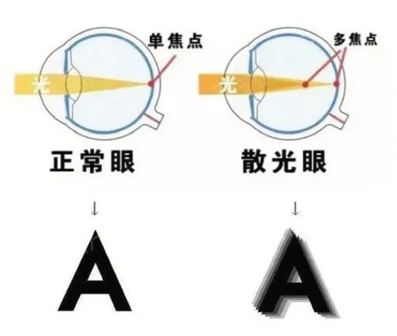 61c例如:球镜为-4.50d表示近视45 0度;球镜为 1.00d表示远视10 0度.