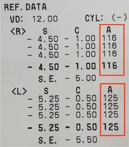 (spherical equivalent)指的是等效球镜, 计算公式为球镜(s) 1/2志档