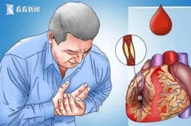 "胸痛"--急诊室的头号致命杀手|心肌梗死_新浪财经_新浪网