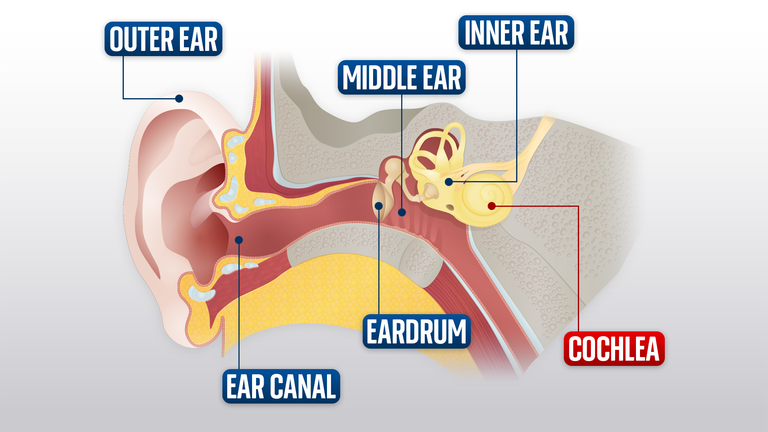 图为基因治疗试验示意图.工作基因从耳蜗部位灌注.