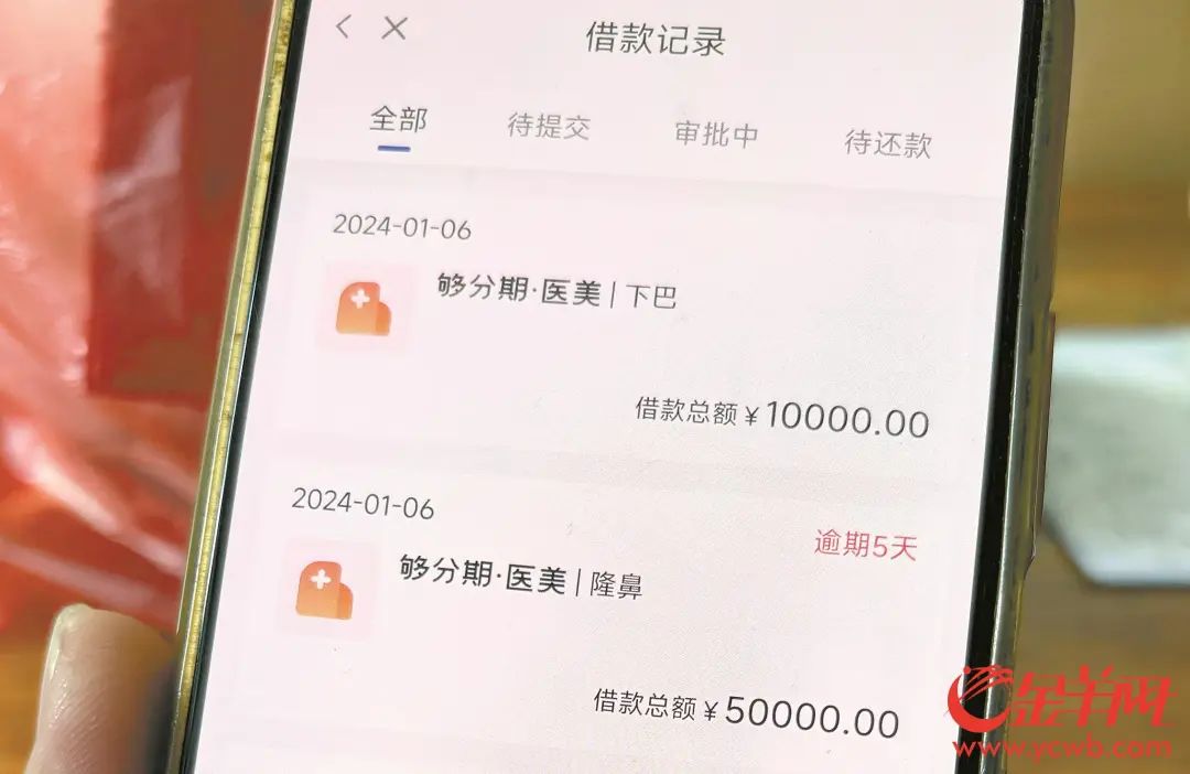 张玥网贷整容6万元，本息共7.6万元