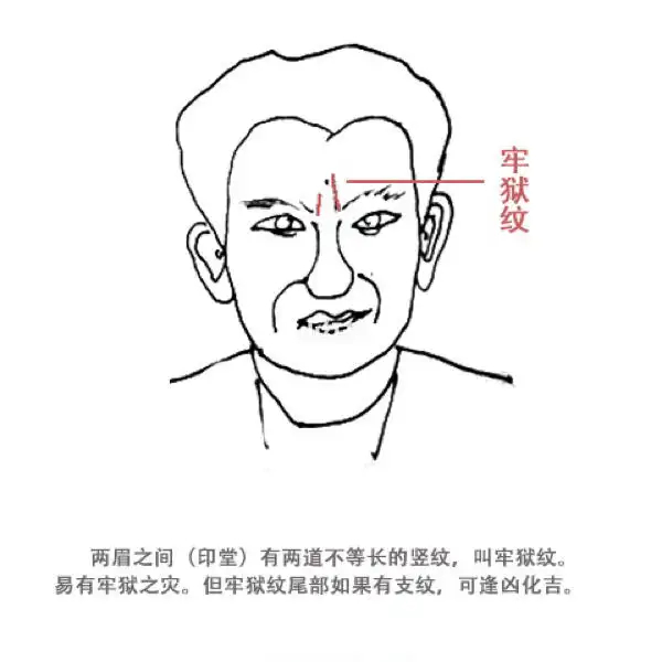 图一为牢狱纹, 牢狱纹一般是靠近眉头位置的斜纹…|聂远|沈腾|竖纹|思多|纹路_新浪新闻