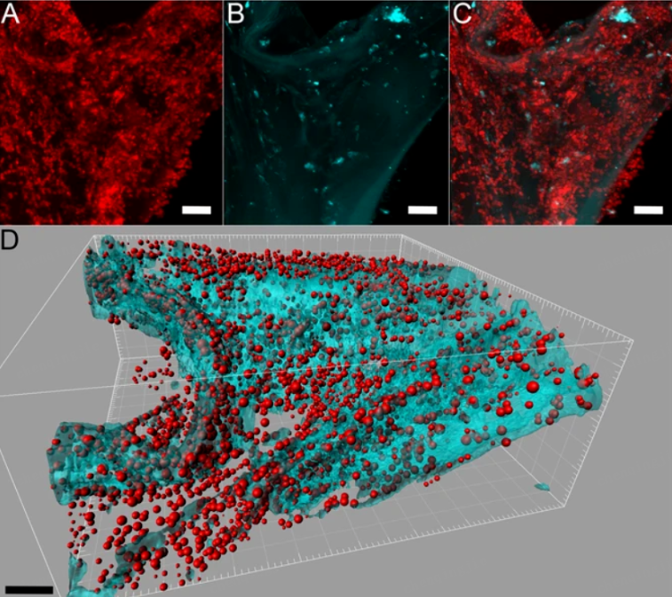 种类繁多的细菌几乎在海绵中的各处均有分布；图中的红色代表细菌菌落，青色则是海绵的自发荧光。图源：参考文献