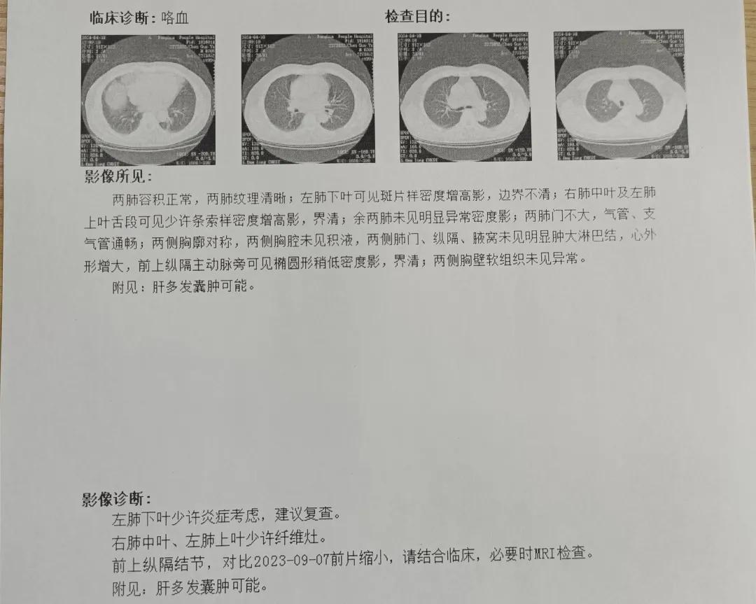 "男子被确诊,医生:有此症状赶紧就医……|肺癌_新浪财经_新浪网