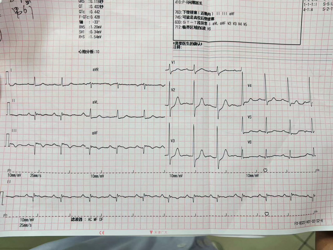 一场心电图医生发起的生命接力