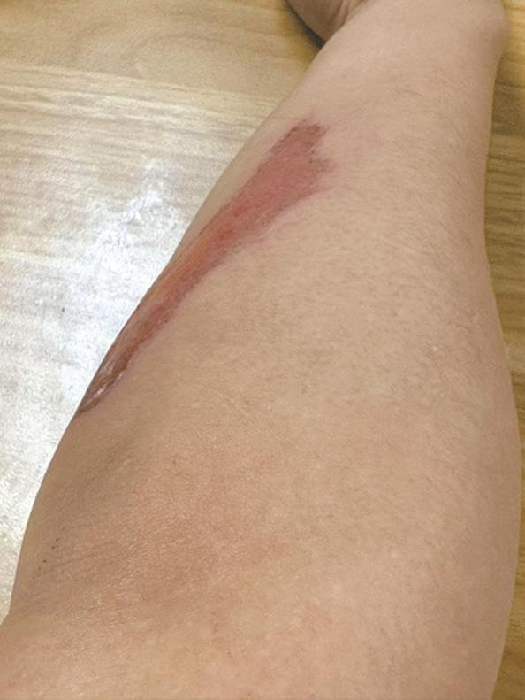 车主维权苦无果 商家处理"踢皮球"