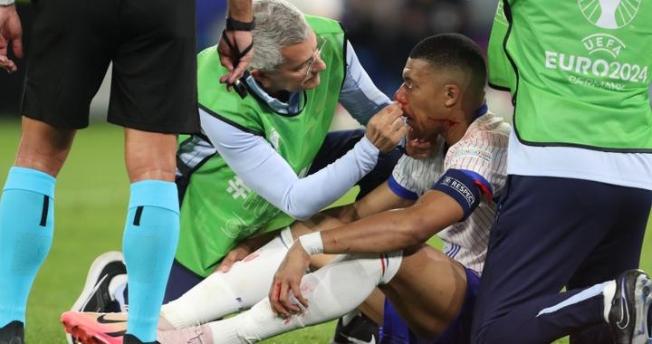 记者：初步检查表明姆巴佩鼻子受到严重影响|基利安·姆巴佩|骨折_新浪新闻