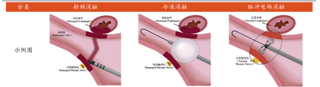 电生理器械怎么销售百亿「电生理市场」的雷雨前夜_https://www.jmylbn.com_新闻资讯_第4张