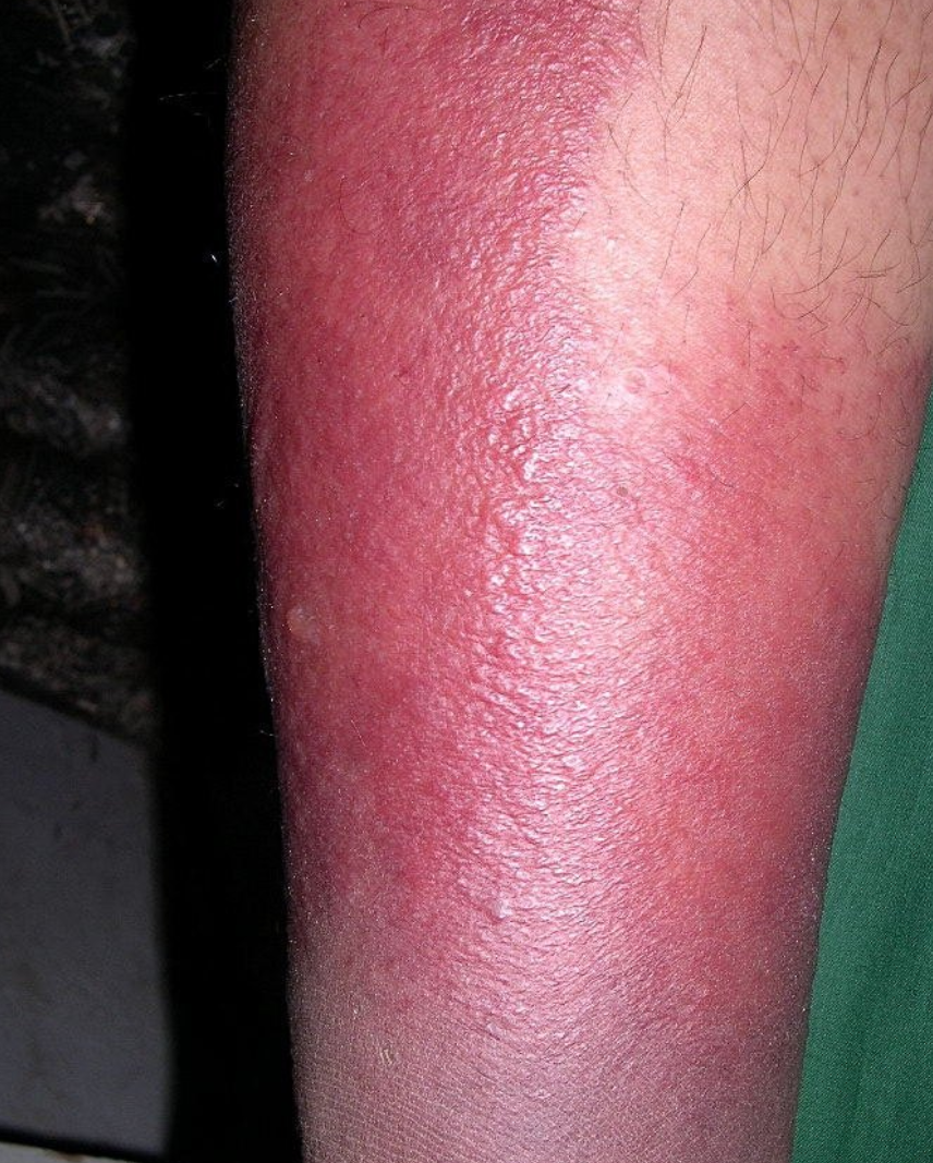 这几类人尤其要注意