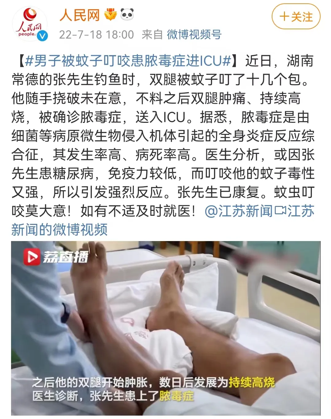 无独有偶，河南省一名5岁的男孩也遭蚊子叮咬患脓毒症进了ICU，孩子在入院时已出现发烧，并且脚腕肿得像成人的大臂那么粗。