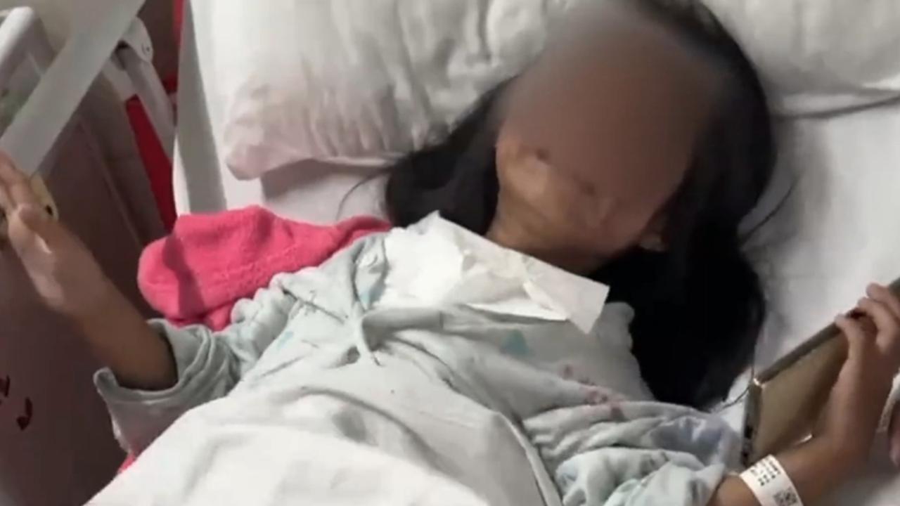 家长称6岁女儿被高年级男生无故泼开水烫伤：开水从脸浇下，二度烫伤脸恐留疤，警方已介入