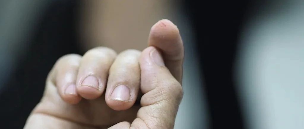 老婆婆不小心划伤手指,十天后竟住进ICU!医生:这些伤口不可大意|广东省|并发症|住院|肺部|破伤风_新浪新闻