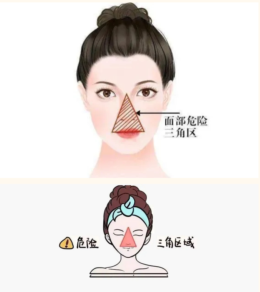 面部的“危险三角区”你知道吗?|三角区|面部|三角形_新浪新闻