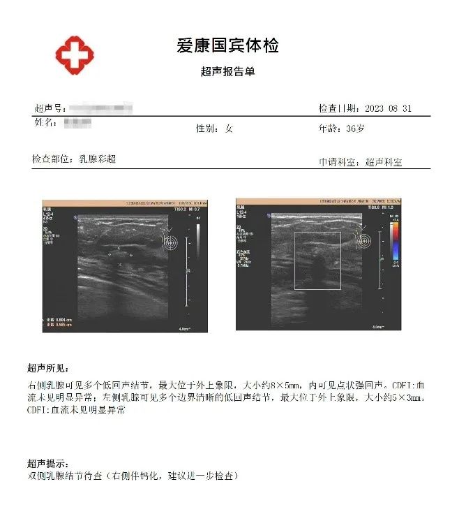 王女士2023年8月在爱康国宾体检中心的超声报告单