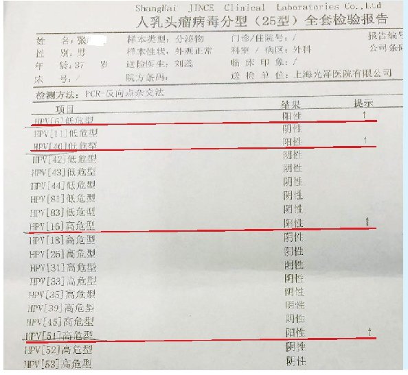 hpv正常报告单图片