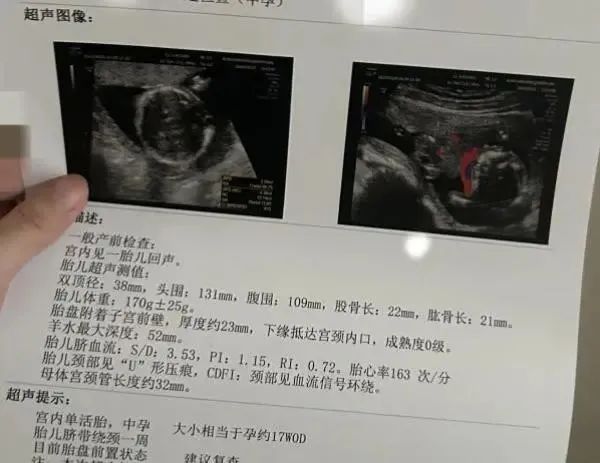 年轻女孩代孕流产,非法代孕哪有“自愿”可言?|昆山市|黑色产业链|违法行为|江苏省|产业链_新浪新闻