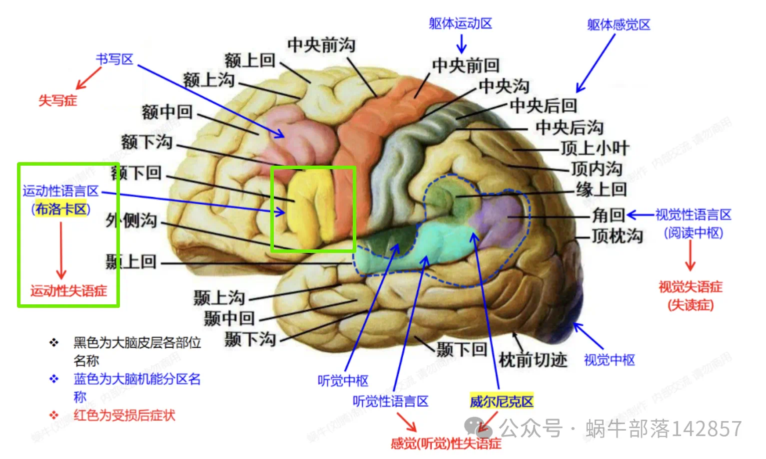 大脑皮层言语区示意图