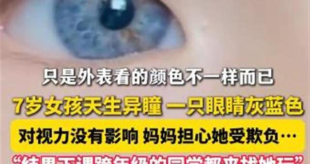 医生回应7岁女孩天生异瞳：虹膜异色症所致|武汉市|湖北省|角膜|美瞳|瞳孔_新浪新闻