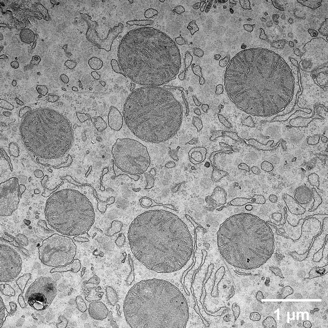 120千伏场发射透射电镜下的小鼠肝脏切片（金属染色）。