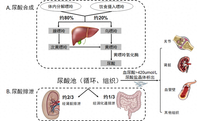 尿酸的代谢途径 来源:中国民族卫生协会重症代谢分会