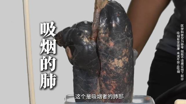 吸烟的危害有多大?来看看健康人的肺与吸烟者的肺🫁……|健康科普|呼吸科|肺部健康对比|肺部疾病|吸烟危害解析_新浪新闻