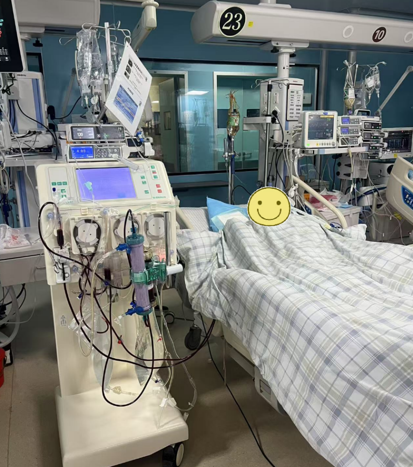 患者正在进行血液灌流串联连续静脉-静脉血液滤过（HP-CVVH）治疗。