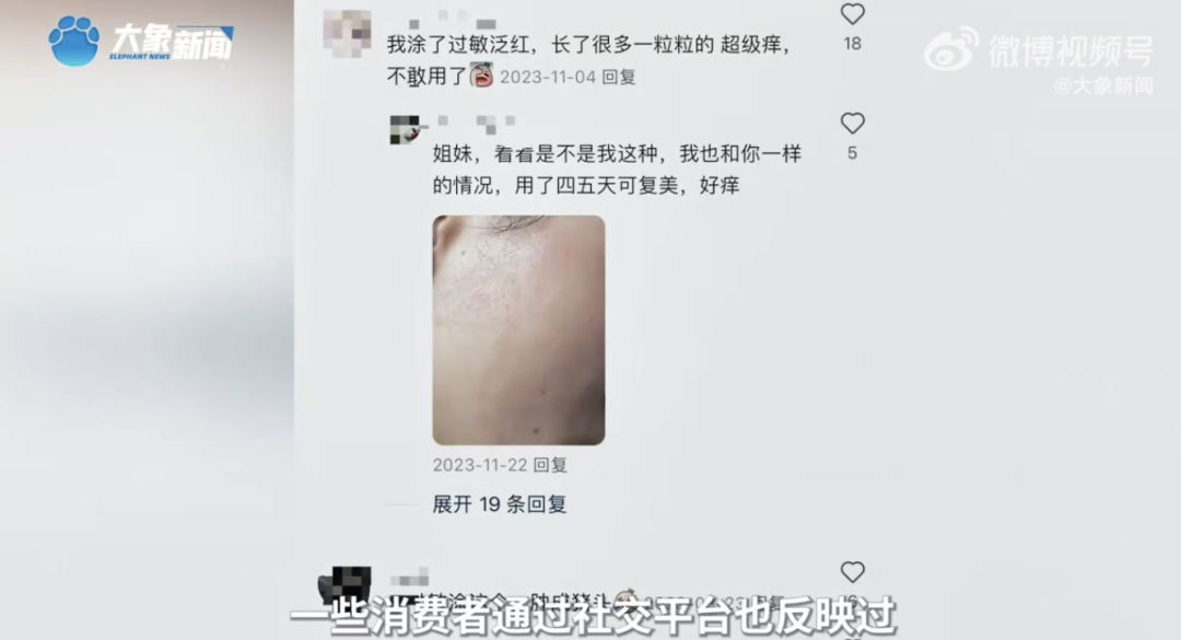 一些消费者通过社交平台也反映过使用可复美产品后面部出现肿胀问题。视频截图
