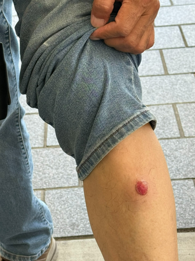 新闻多一度丨催泪弹,震爆弹齐发