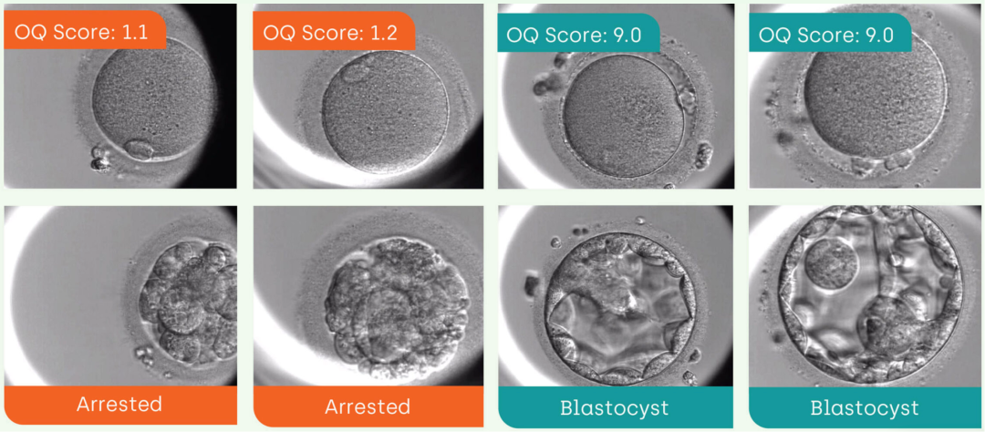 博客地址：https://fairtility.com/chloe-oq-for-egg-freezing/